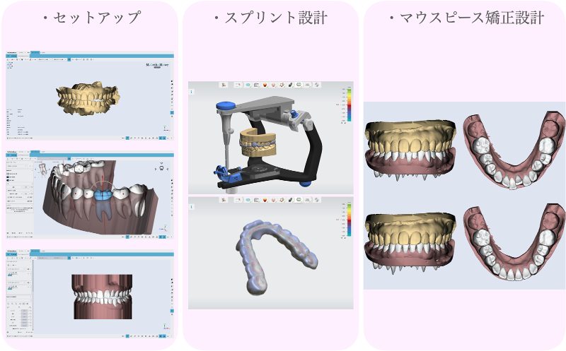 株式会社 SPADE (デジタル矯正・マウスピース矯正・矯正専門技工所)のアルバイト・バイト求人情報-03