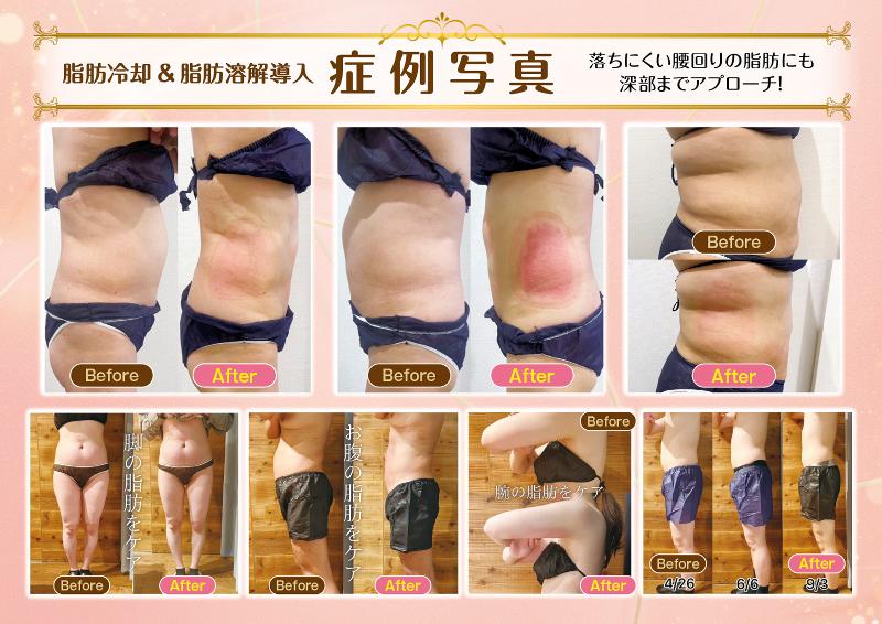 痩身 salon ルミナスのアルバイト・バイト求人情報-05