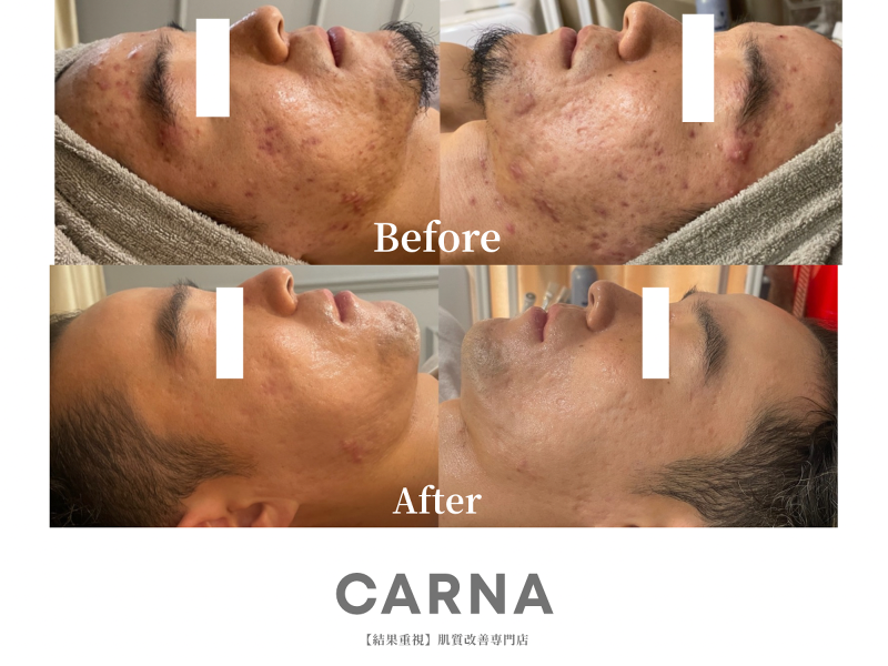 Beauty Salon CARNAのアルバイト・バイト求人情報-04